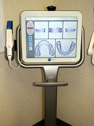 ITERO SCANNER — Valiente Dental